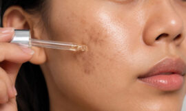 The Best Ingredients to Fade Hyperpigmentation and Dark Spots