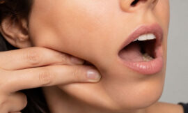 Does Intra-Oral Facial Massage Actually Lift Your Jawline?