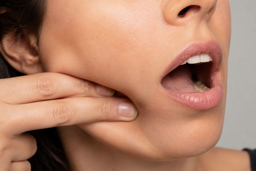 Read more about the article Does Intra-Oral Facial Massage Actually Lift Your Jawline?
