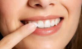 How to Safely Whiten Sensitive Teeth at Home