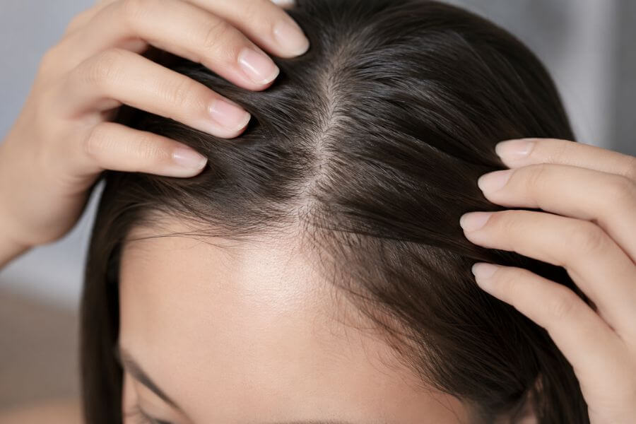 Read more about the article The Ultimate Guide to Scalp Skinification and Hair Longevity in 2026